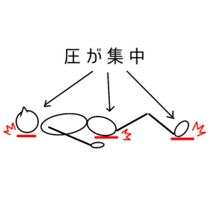 図解 圧が集中