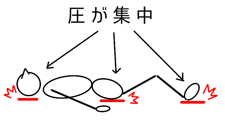 図解　圧が集中